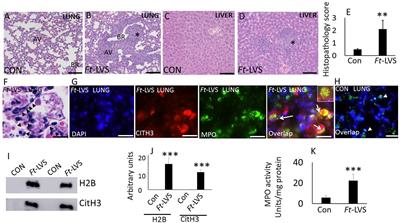 Production of Neutrophil Extracellular Traps Contributes to the Pathogenesis of Francisella tularemia